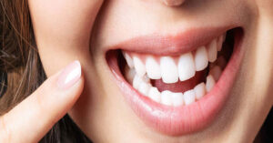 Gülüş Estetiği Nasıl Yapılır? Gülüş Estetiği Nasıl Yapılır?